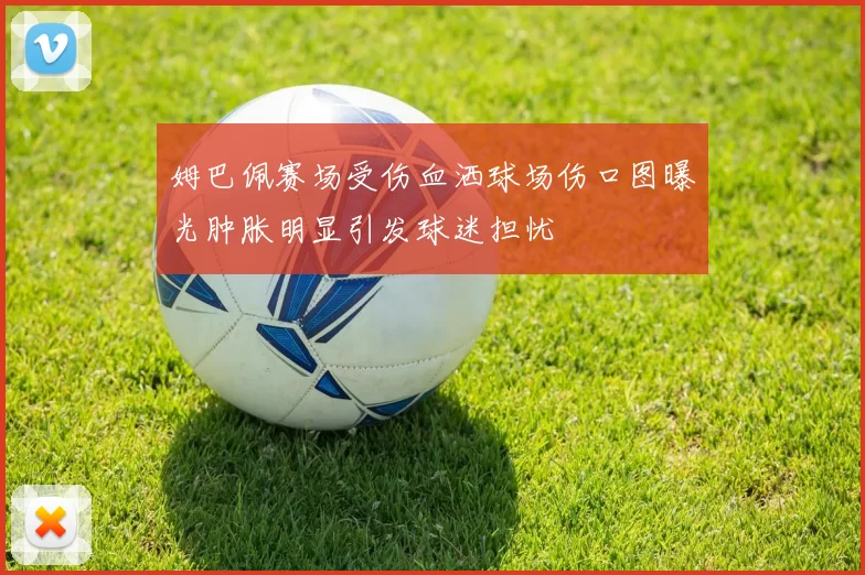 姆巴佩赛场受伤血洒球场伤口图曝光肿胀明显引发球迷担忧